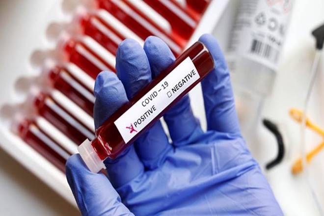 کورونا وائرس: دہلی میں پہلی بار ریپیڈ سے زیادہ آر ٹی پی سی آر ٹیسٹ ہوئے
